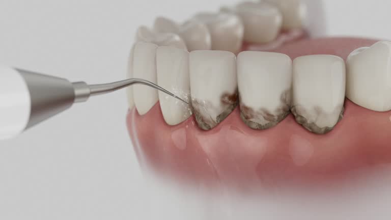 Trusted Root Canal Treatment service in Brookwood, AL - Dentist Open Now